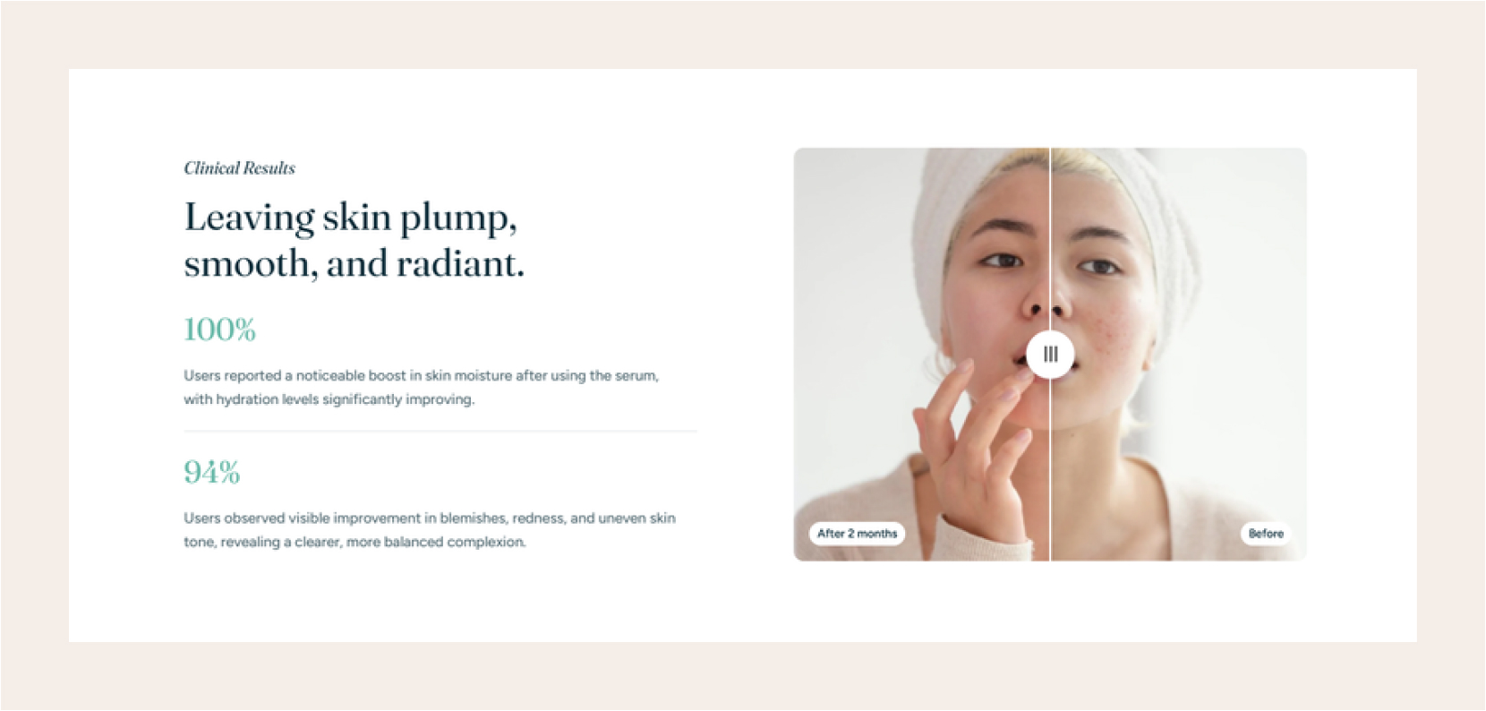 Text block for Before/after image slider section