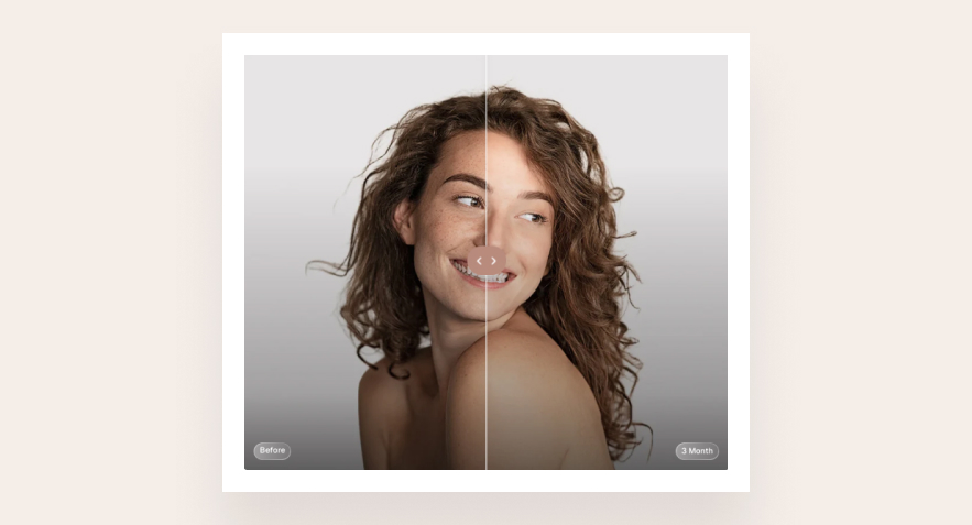 Image comparison